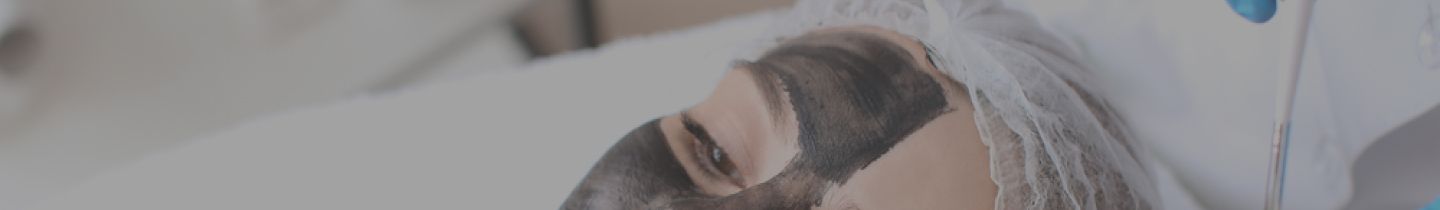 carbonPeeling